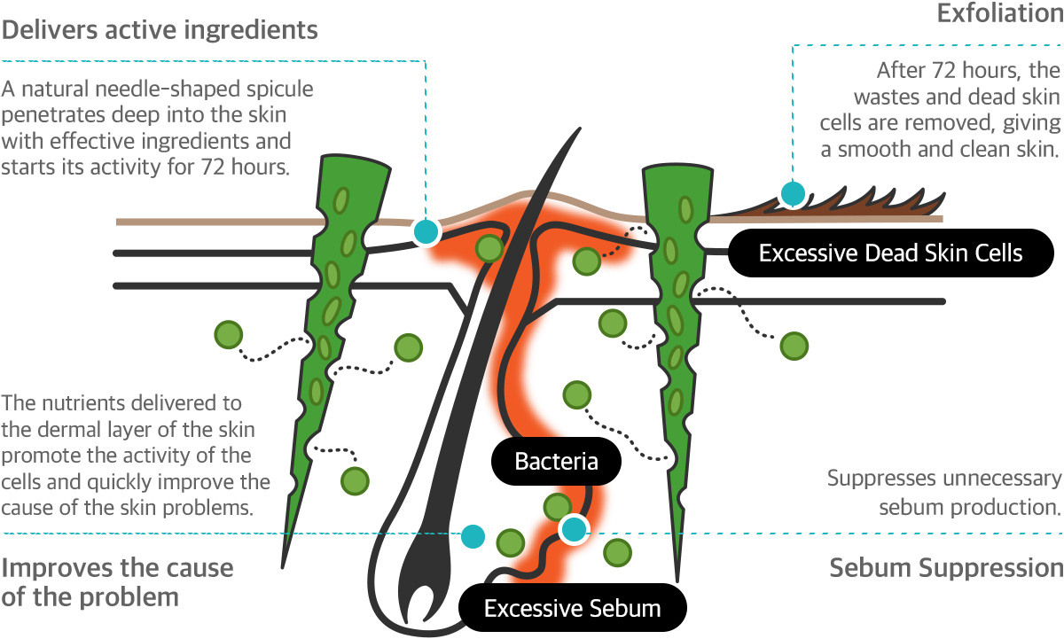 The principle of skin regeneration of spicule